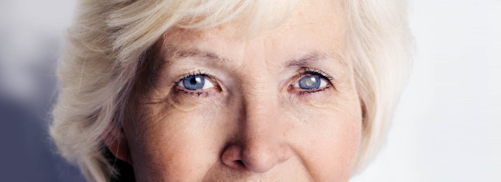 Cataract Surgery in Hudson