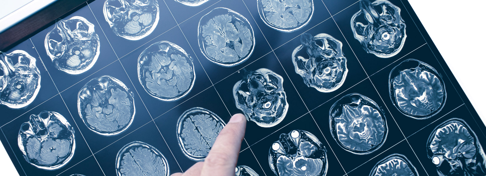Neuro-Optometry in Hudson
